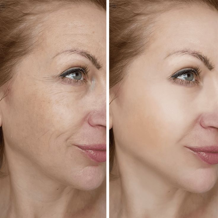 BelleCelestia™ 7-in-1 LED Face & Neck Sculptor