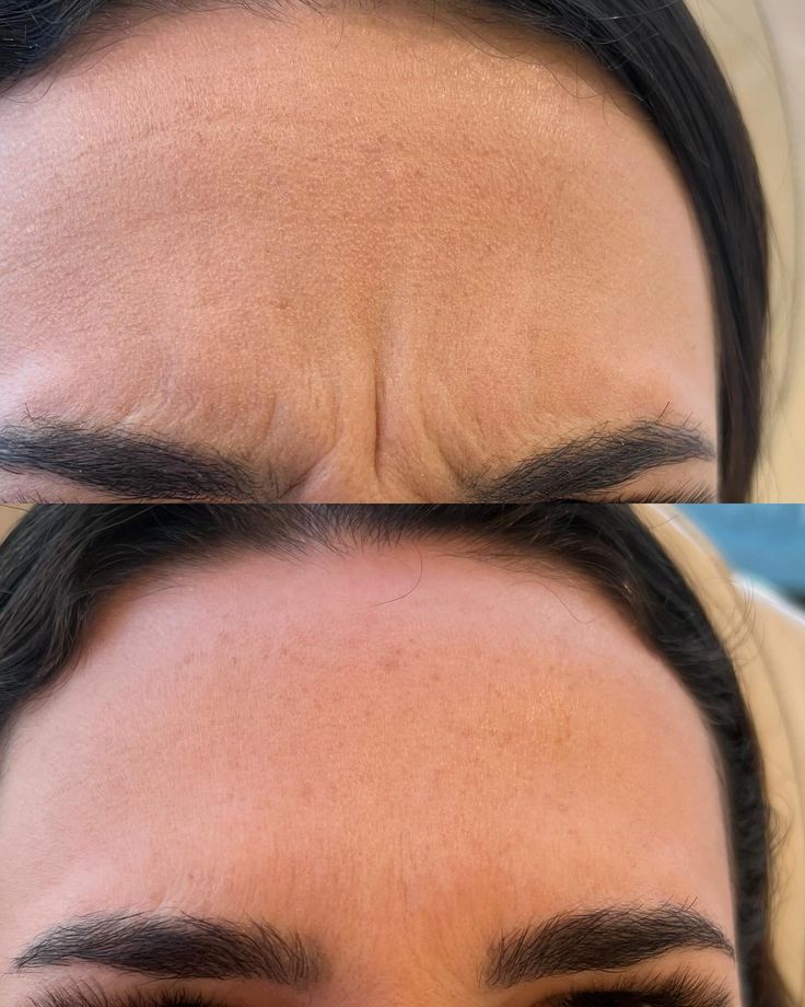 BelleCelestia™ 7-in-1 LED Face & Neck Sculptor