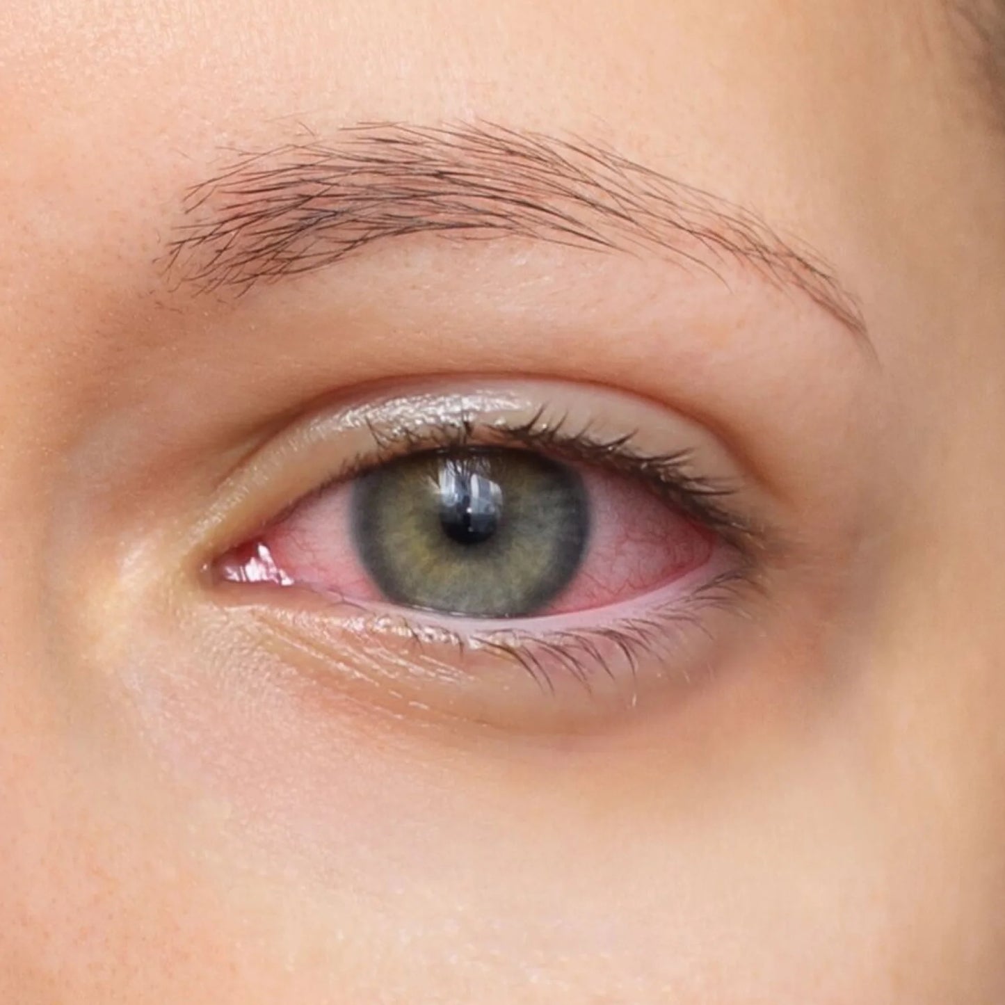 BelleCelestia™ AuraMist Eye Device